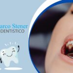 Igiene orale e prevenzione a Trieste Studio Dentistico Dott. Marco Stener
