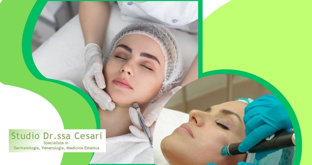 studio dr.ssa cesari Studio di dermatologia e venereologia a Udine: qualità professionale e competenza - immagine 1